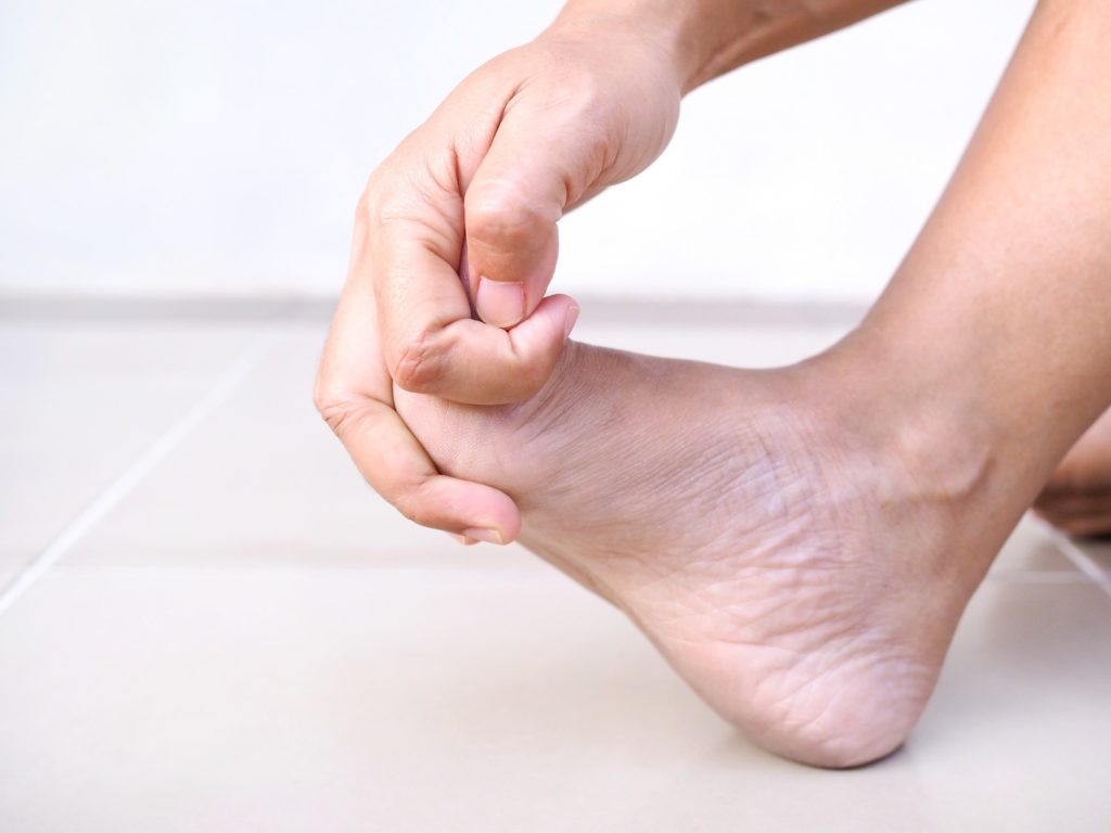 Gout in the foot - Symptom foot pain and numbness in feet of adult women or ache from bunion disease or plantar